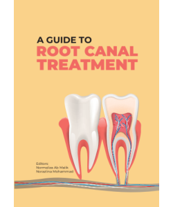 A GUIDE TO ROOT CANAL TREATMENT