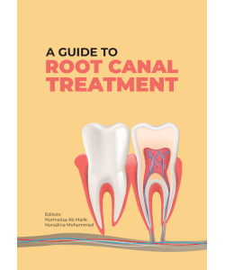 A GUIDE TO ROOT CANAL TREATMENT